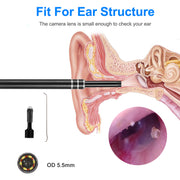 Ear Endoscope Otoscope Visual Earpick Ear Cleaning Camera Ear Wax Removal Tool IP67 Waterproof 3 in 1 Borescope w/ 6 Adjustable LED for Android