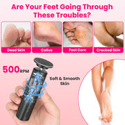 Electric Foot Callus Remover & Nail Grinder with 6 Speeds
