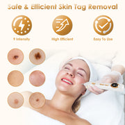 Portable Skin Tag Remover Pen with LED Light 9 Intensity Gears Cordless Rechargeable Skin Tag Removal Kit Intended for Common Warts Mole Skin Tags Gif